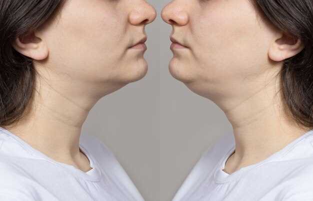 Объяснение слова Double chin на русском языке